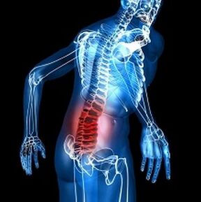 osteochondróza