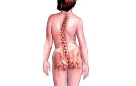 dôvody pre rozvoj cervikálnej osteochondrózy