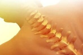 osteochondróza ako liečiť